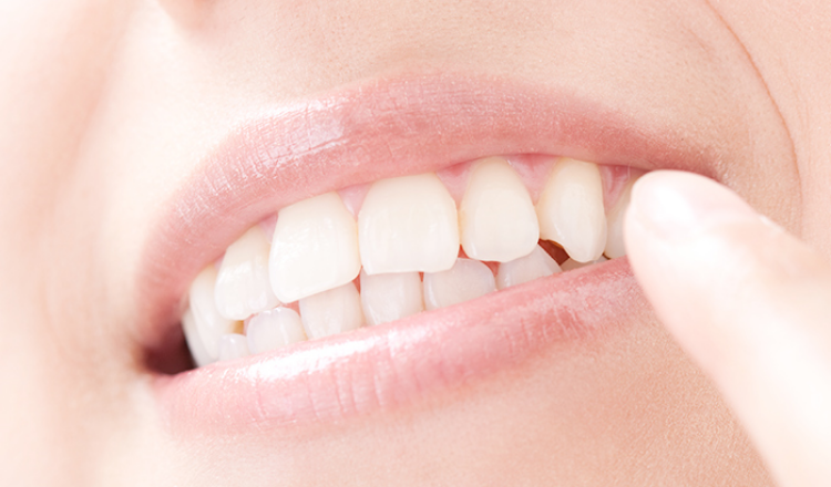 POINT03 歯を支える歯周組織を健康に